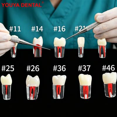 20pcs Dental Endo Training Model Resin Root Canal Block RCT Practice Teeth Pulp Cavity Tooth Model for Dentist Students Studying