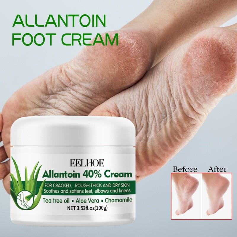 Eelhoe Nourishing Foot Care Cream For Dry Cracked Skin Moisturizing And Hydrating 100g