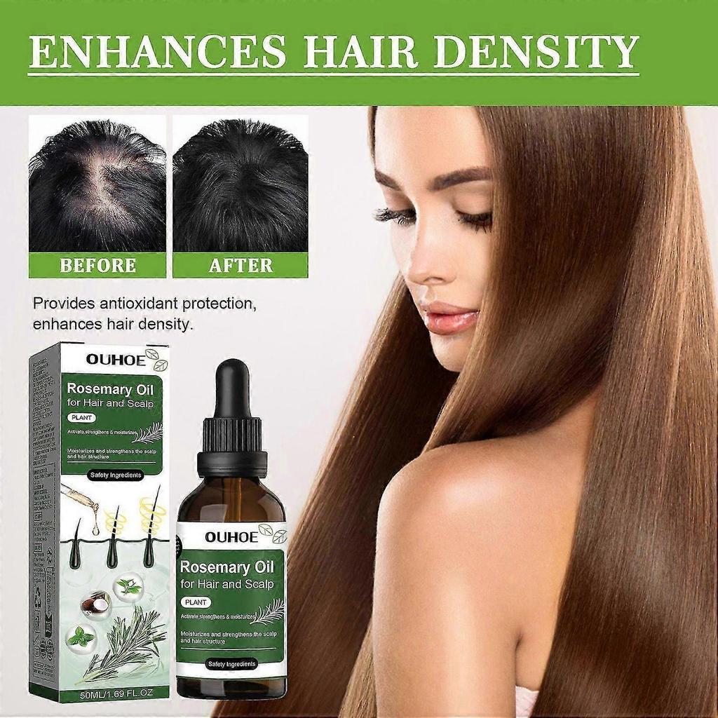 1-3x Rosemary Oil For Hair And Scalp-hair Oil For Hair Loss To Stimulate Hair Growth With Castor Oil 50Ml