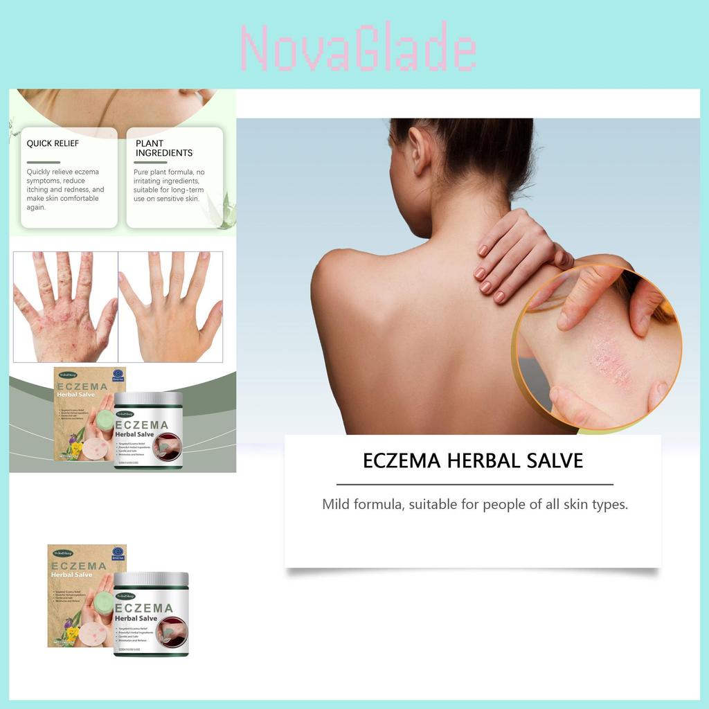 Woodsleep Herbal Cream Natural Formula For Soothing Skin Redness And Bumps