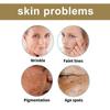 Eelhoe Collagen Essence Serum - Gentle Hydrating And Moisturizing, Anti-Wrinkle, Brightening, Repairing, Acne Skin Care Essence