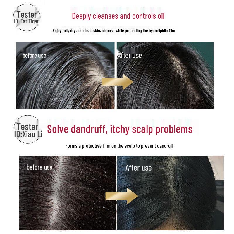 Selsun Green Tea Seed Anti-Dandruff Shampoo & Silk Conditioner Set