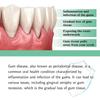 South Moon Gum Care Drops - Protect Gums, Relieve Periodontal Blisters, Oral Hygiene Care Drops