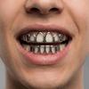 2Pcs/Set Classic Charm Teeth Grillz Hip Hop Hollowed-Out Teeth Caps  Tooth Socket