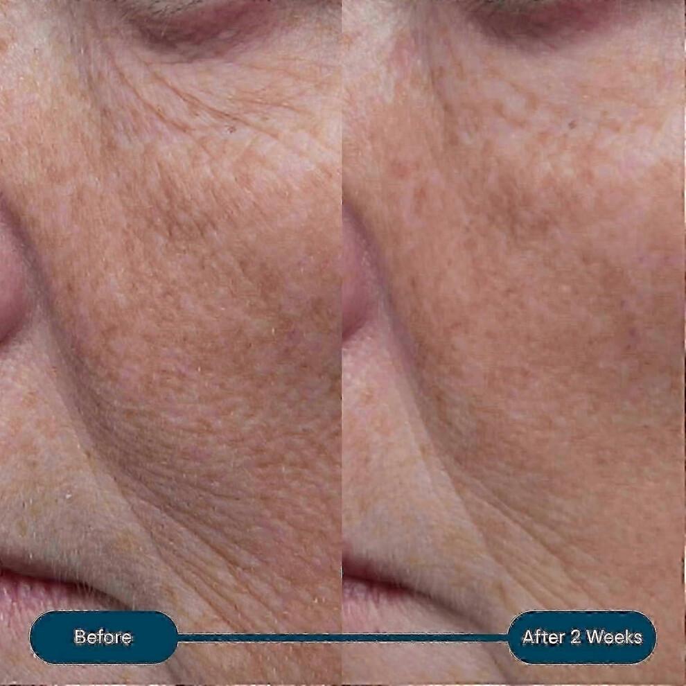 Collagen Marine Cream, Anti-Wrinkle Daily Face Moisturising Lotion,Suitable for All Skin Types 25-26