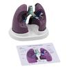 Anatomical Pathological Lung Model Human Lung Anatomy Model Normal and Pathological Lung Anatomy Model for Teaching Tool