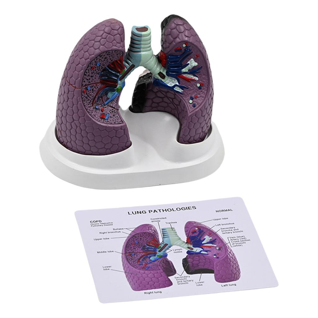 Anatomical Pathological Lung Model Human Lung Anatomy Model Normal and Pathological Lung Anatomy Model for Teaching Tool