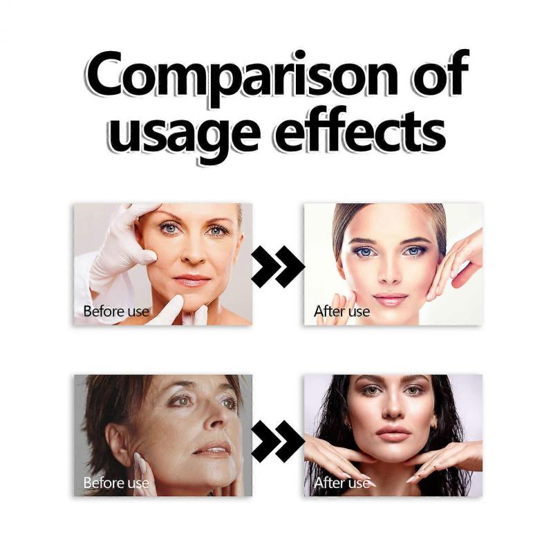 Hoygi wrinkle-reducing essence facial firming skin anti-wrinkle anti-aging