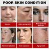 Powerful Spot-removing Whiten Cream Brighten Skin Fast Eliminates Melanin Pigmentation Melasma Dark Spots Moisturize Skin Care