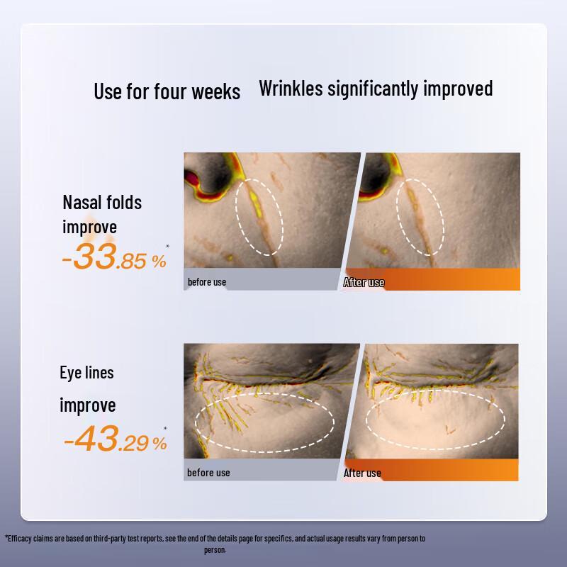 Yaman LIFT Gold V-Face Beauty Device