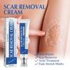 1-3x Acnes Scars Removal Cream Effectiveness Non-irritating Cream For Face