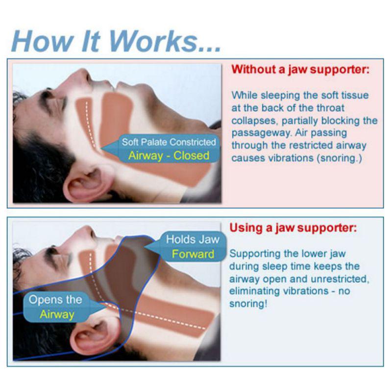 Newly Mini Snore Stopper Adjustable Snore Reduction Straps Anti Apnea Snore Support Belt Jaw Sleep Band Snoring Chin Strap