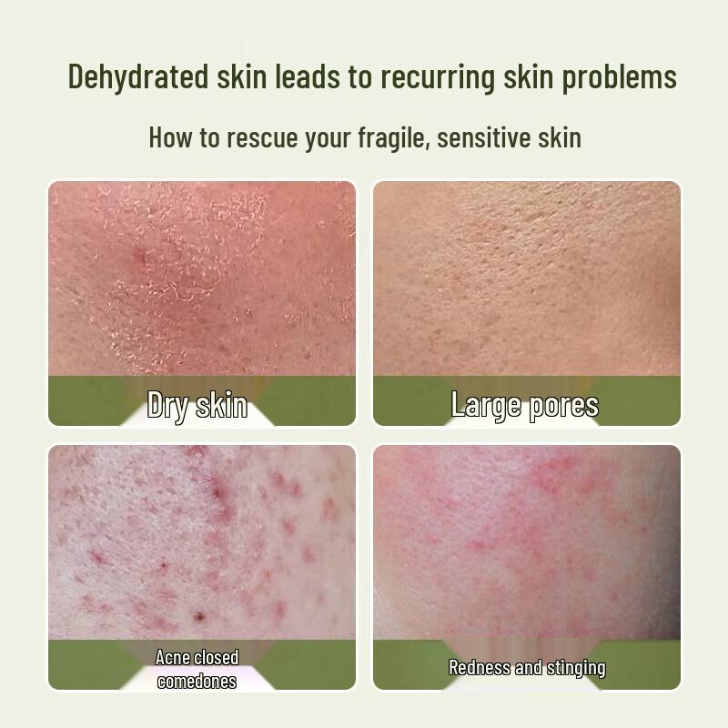 BEAUTY NOTES Natural Aloe Vera Gel