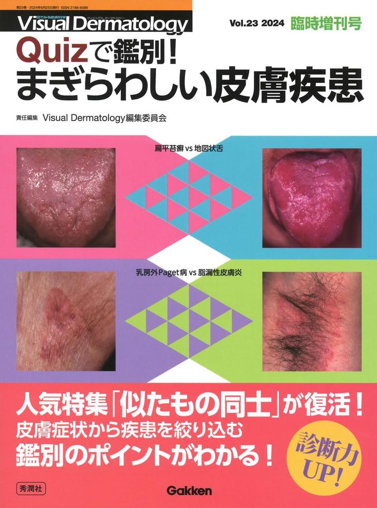 Differentiate with Confusing Skin Diseases Quiz!