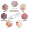 Skin Scrubber Face Skin Spatula Blackhead Remover Pore Cleaner Face Beauty Lifting Tool Comedones Extractor With 4 Modes, Facial Scrubber Spatula For