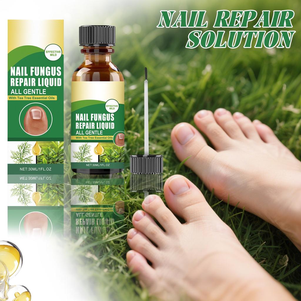 Nail Care Liquid Strengthens Nails , Reduces Cracking And Thickening. It Is A Suitable Nail Liquid For Athletes ,30ml ,