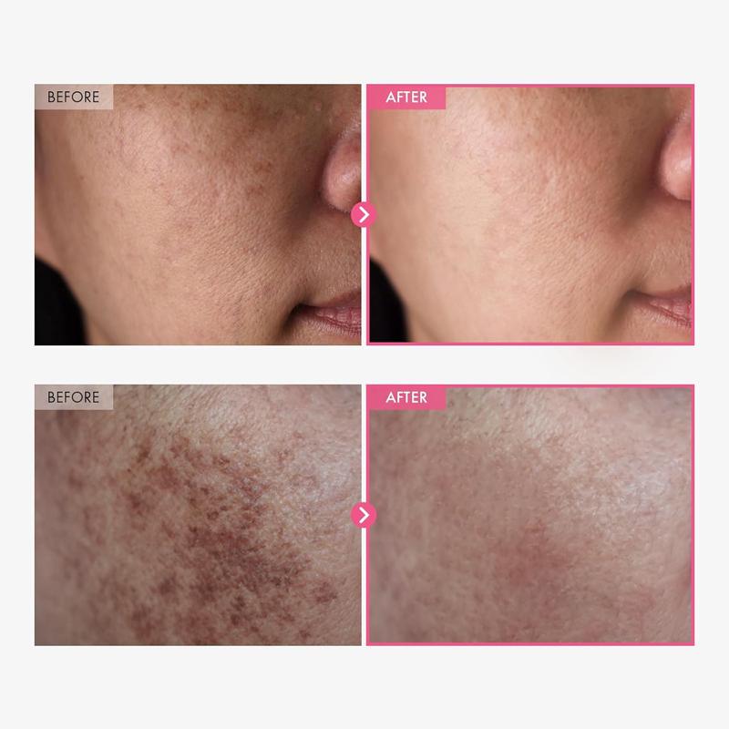 TOSOWOONG Crème Arbutine 7.0 + TXA 4.0 50ml