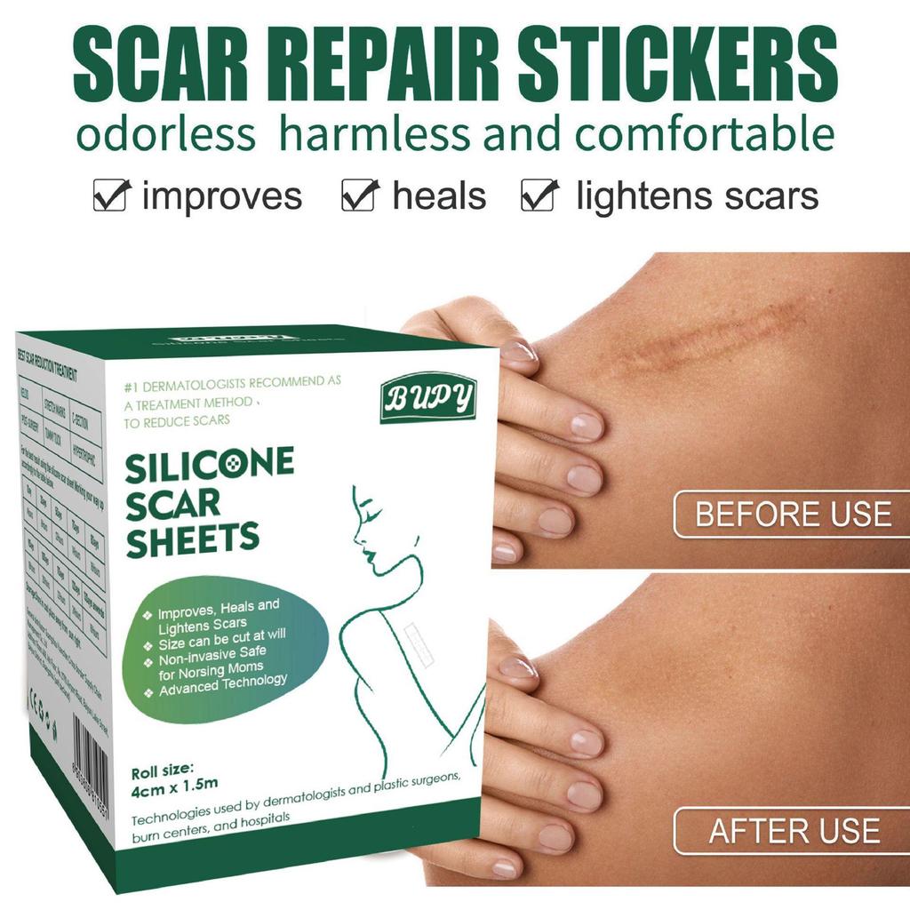 Adjustable Silicone Gel Scar Sticker Roll for Surgical Scar Repair