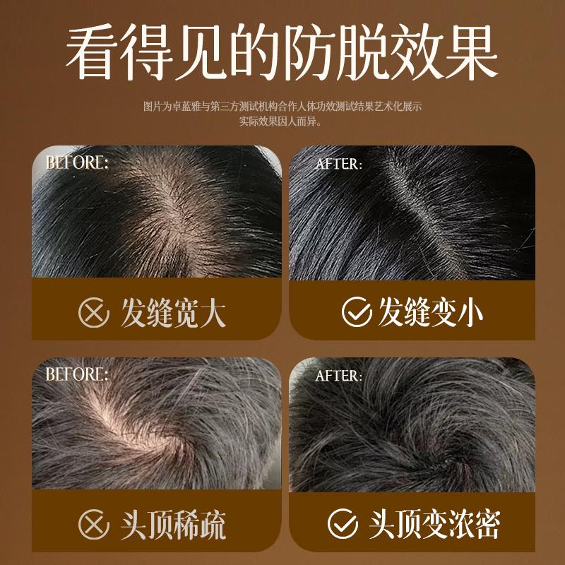 [Best Buy Runout King with Certificate to Prevent Hair Dropping] Anti dropping and hair firming scalp essence small gold bottle 15ml