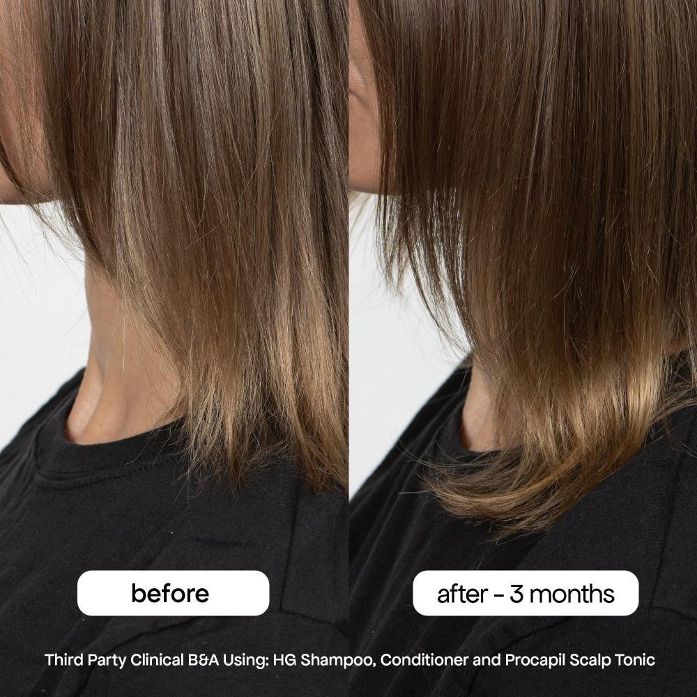Bondi Boost Travel Size Hg Anti Thinning Conditioner 3.04 Oz
