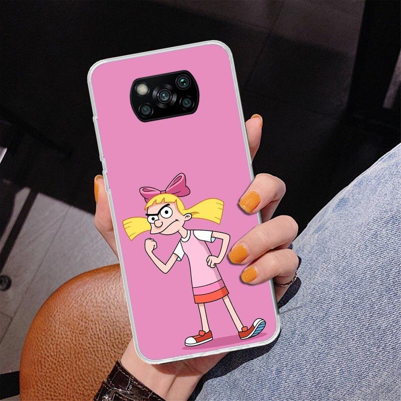 Cartoon Hey Arnold Fondos Phnoe Case for Xiaomi Poco X5 X6 X7 Pro X4 Gt F7 Ultra M8 M7 Redmi 15C 15 13C 13 12C 12 Unique Cover C
