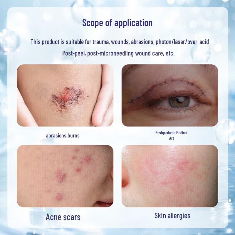 Kangruibao Human Growth Factor Scar Repair Gel