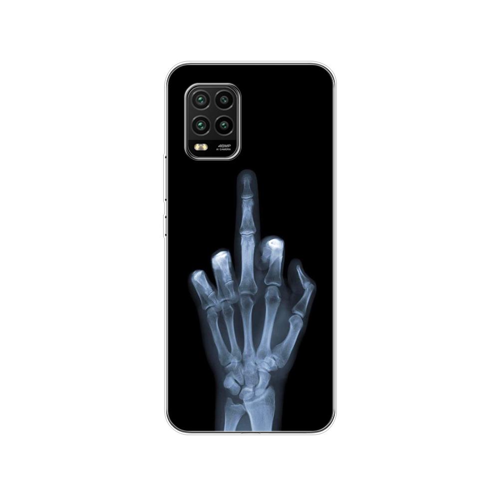 For Xiaomi Mi 10 Lite Case 6.57" Soft Silicon Tpu Cover For Xiaomi Mi 10Lite 5G Mi10Lite Phone Back Shell Bumper Funda