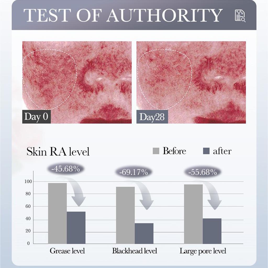 DEEPLY CLEANSE SOOTHING SHRINK SKIN PORES,Clean And Tighten Facial Mud Mask Stick, Easy To Apply, Easy To Rinse 40g