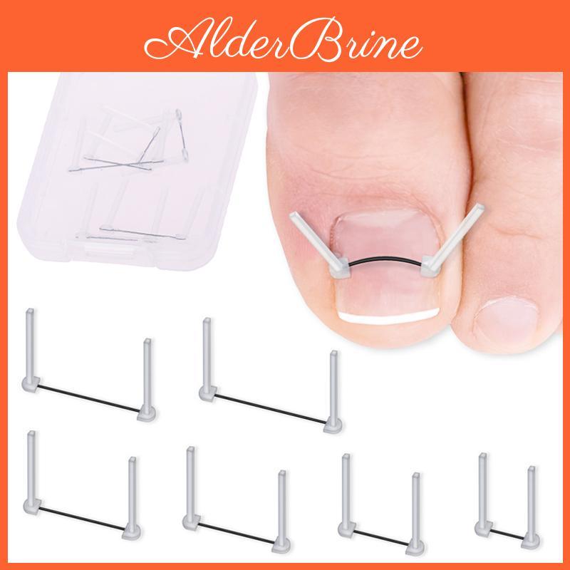 Foot Toenail Ingrown Correction Wire Care Tools Professional Treatment Recover Embed Toe Nail Pedicure Straightening Toe Tools