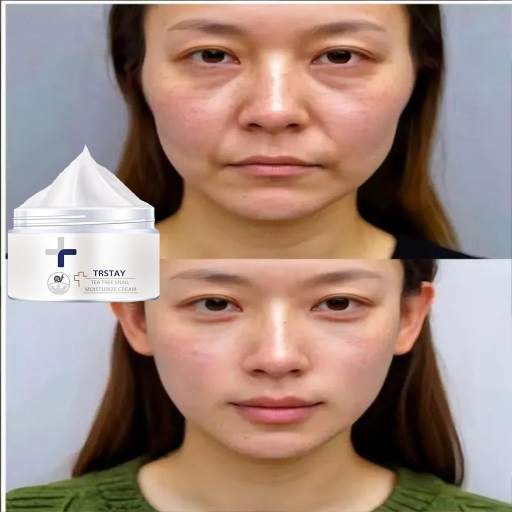 Moisturizing Cream Is Gentle and Non-irritating, Firms the Skin, Brightens the Complexion, Reduces Blemishes, Hydrates and Nourishes the Skin