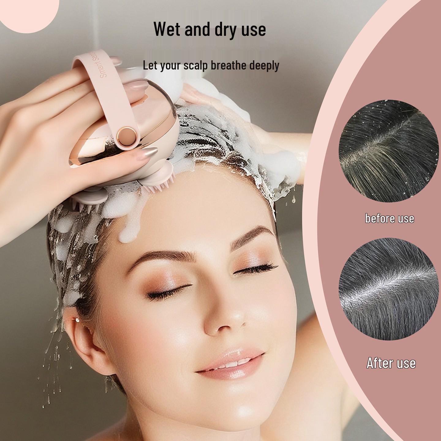 

Portable Scalp Acupoint Massager with Red Light Therapy for Head and Pet Relaxation Яскраво-рожевий/срібний