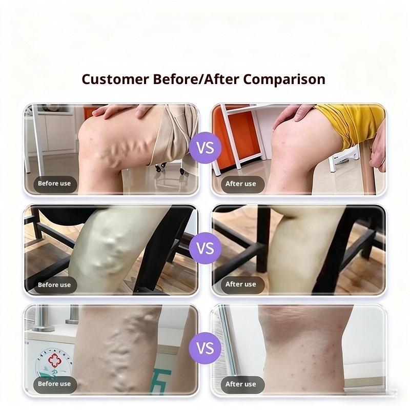 Soothing Cream for Varicose Veins, Red Blood