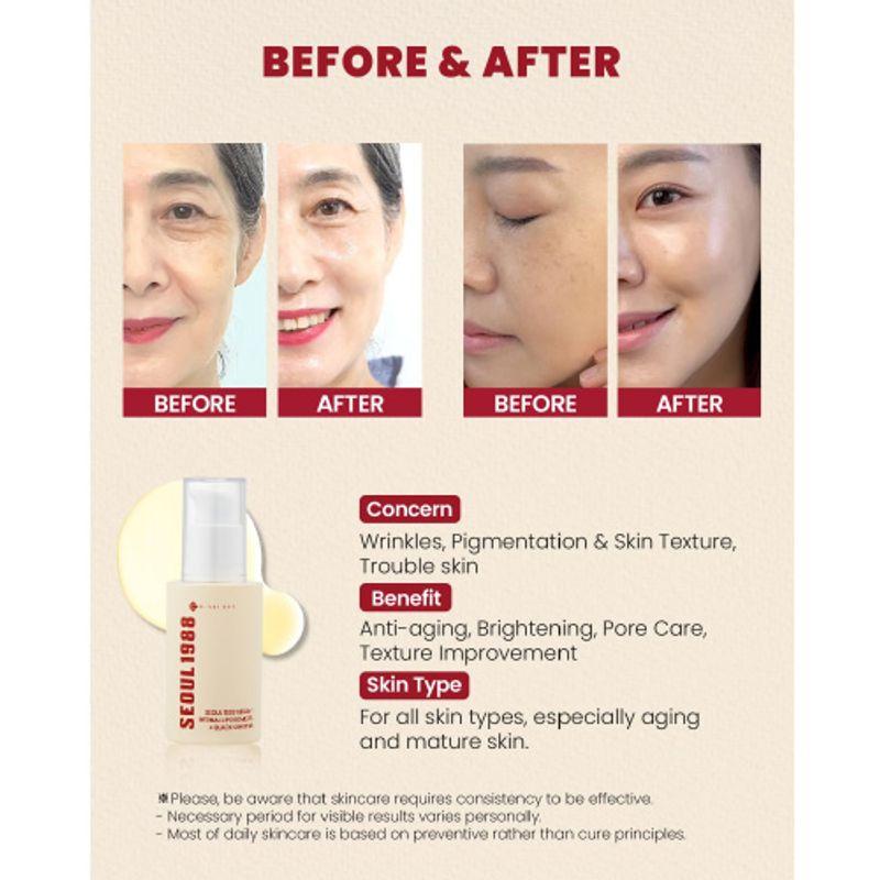 KSECRET *TIMEDEAL* SEOUL 1988 Serum Retinal Liposome 2% + Black Ginseng 30ml