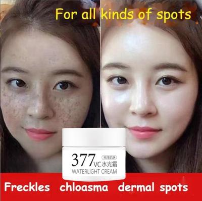 377 Whitening Cream VC Cream Freckles Chloasma Senile Plaques Beauty Salons Yellowing Cream Control Cream