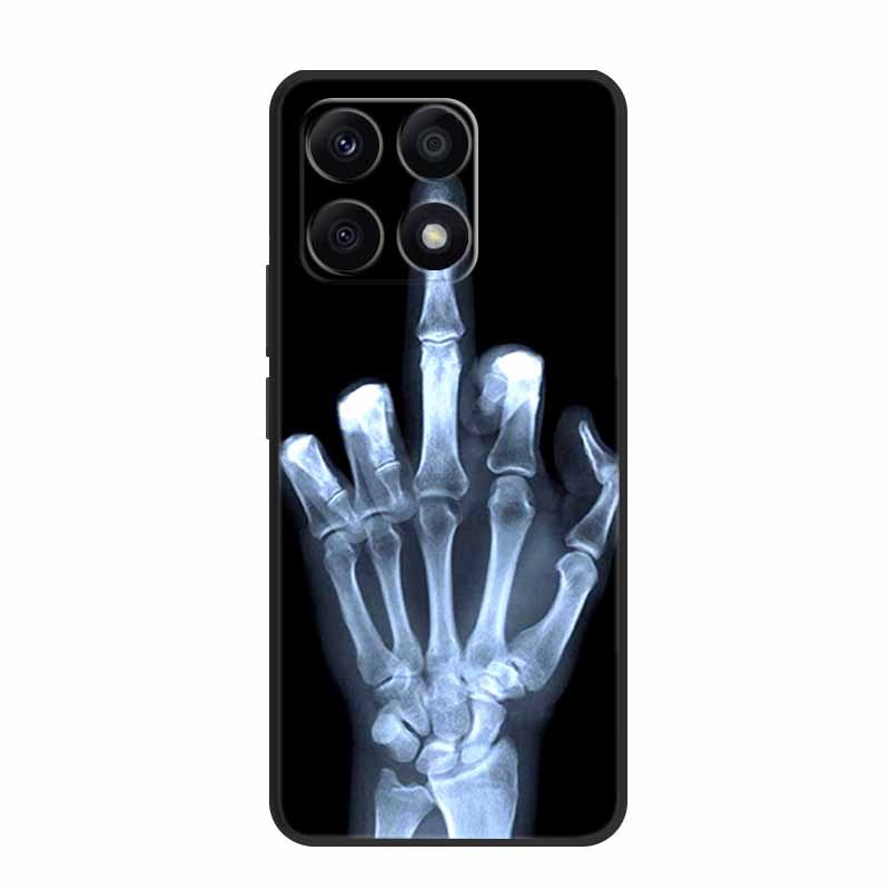 Für Xiaomi 14T Pro Hülle 14 T Pro Handyhülle Löwe Wolf Schwarz Silikon Weiche Rückseite Hüllen Für Xiaomi 14T Pro Hülle 14TPro Funda