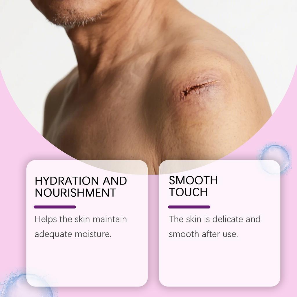 Silicone Scar Gel And Scar Cream Can Fade Uneven Skin Tone, Dullness, Burn And Scald Scar. Suitable For All Skin Types