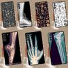 X-Ray Human Anatomy Case For Samsung Galaxy S22 S23 S24 Ultra Note 20 10 Plus S8 S9 S10 S20 FE S21 FE Cover