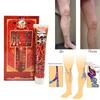 Natural Extract Varicose Vein Relief Vasculitis Phlebitis Spider and Improved Circulation