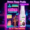 Spray Hidratante Herbal para Pés - Aloe Vera e Chá Verde | Controle do Suor e Pele Macia