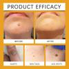 Paste Gram  Paste Skin Care Flat  Ointment  Removal