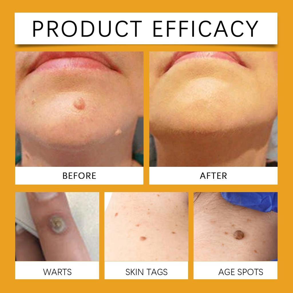 Paste Gram  Paste Skin Care Flat  Ointment  Removal