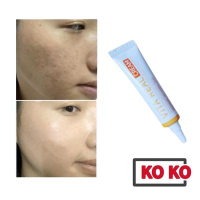 [CHAKAN] Crema Vita Real (Schiarente e sbiancante) 15 ml per il miglioramento delle lentiggini