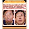 Whitening and Freckle Removing Cream Face Cream Lightening and Removing Spotles Sunburn Brightening Skin Color