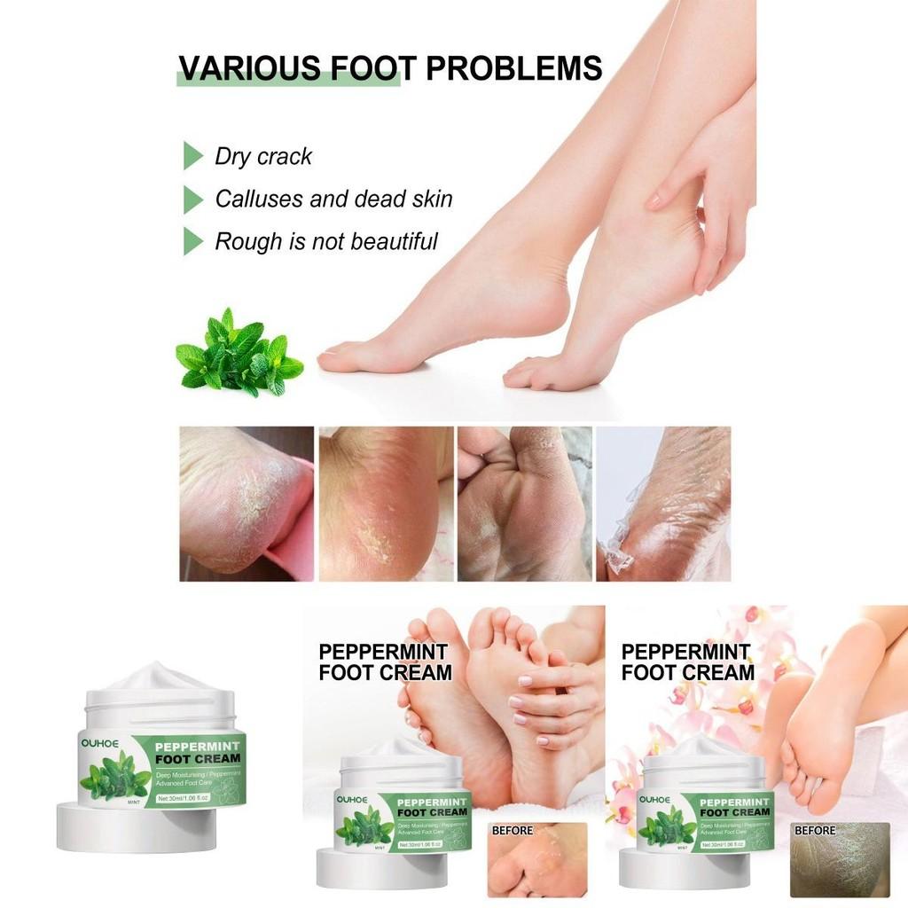 Ouhoe Moisturizing Foot Cream Rich Healing Formula For Dry Cracked Heels And Skin