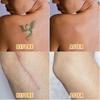 5-Pack Breathable Tattoo Blemish Concealing Tape, Scar Blemish Hiding Tape Sticker, Tattoo Cover and Skin Shield Coverlight Skin Tone