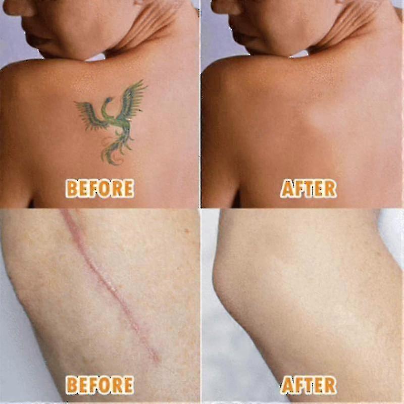 5-Pack Breathable Tattoo Blemish Concealing Tape, Scar Blemish Hiding Tape Sticker, Tattoo Cover and Skin Shield Coverlight Skin Tone