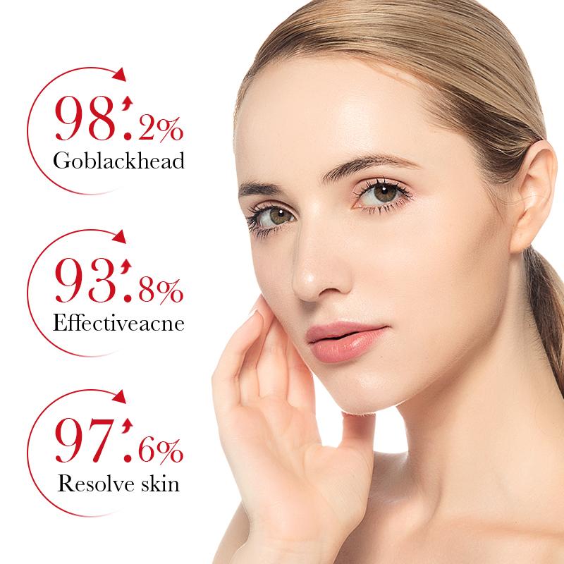 BIOAOUA Salicylic Acid Acne Cream Shrink Pore Cream Elimination Large Pores Remove Blackehead Repairing Skin Care Facial Cream