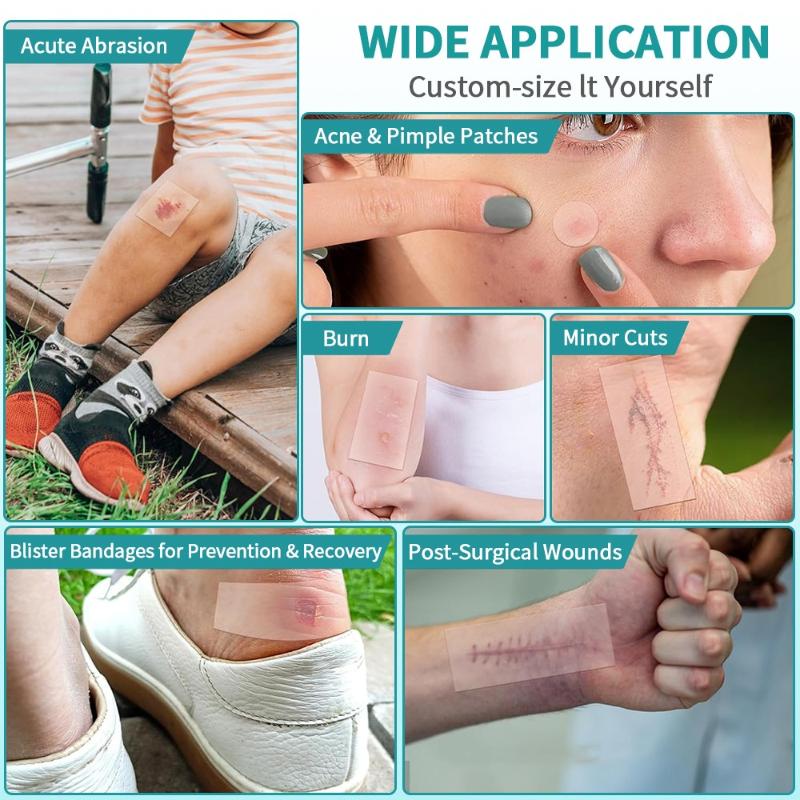 Hydrokolloidrull for sårbehandling Hydrokolloidplasterbandasjer med selvklebende, liggesårbandasjer, svært absorberende for brannskade