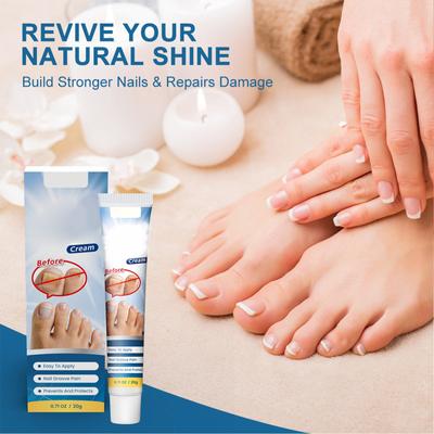 Creme para unhas, melhora a dureza das unhas, clareia a cor das unhas