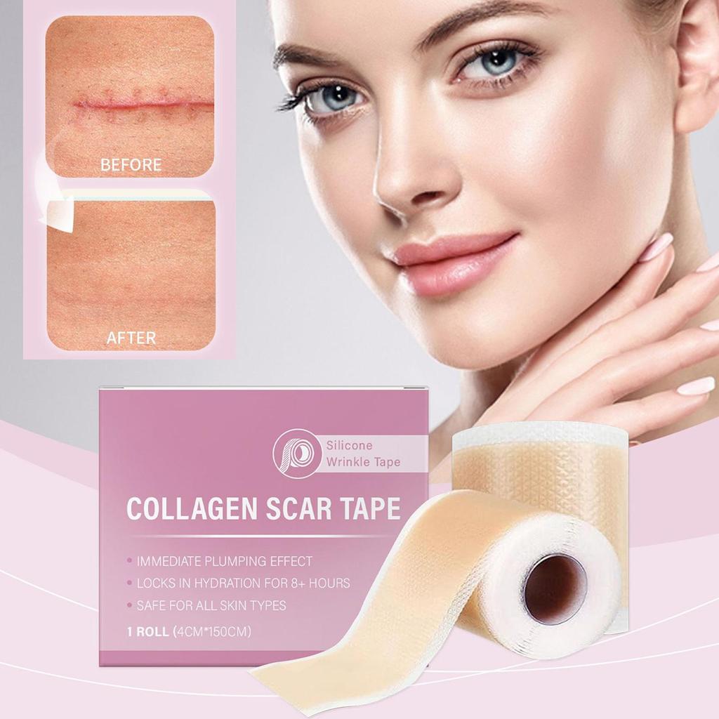 Silicone Scar Patch 4x150cm Waterproof Keloid Removal Strip Effective Scar Therapy Self-Adhesive Tape for Surgical Acne Burn